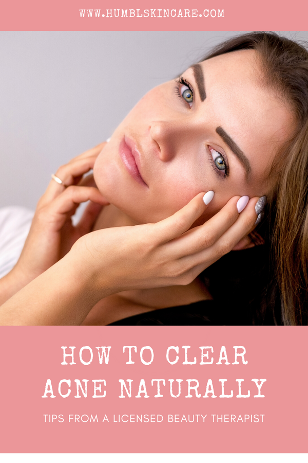 7 TIPS TO CLEARING ACNE NATURALLY